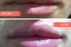 Lips-2